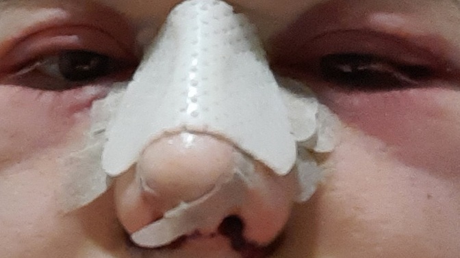 Güzel olcaz diye bu acılar çekilir mi, siz girer misiniz bu toplara kızlar?