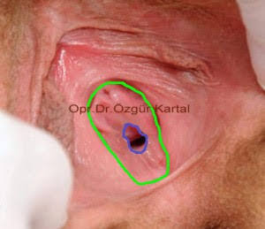 Erkeklerde bakire kız fantezisi var mı ve fantezi kurarlar mı çok? Kimse bakire olduğuma inanmıyor, şaşırıyorlar neden?