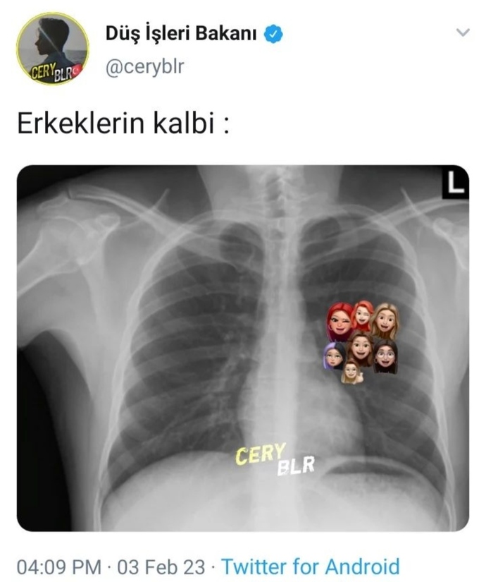 Hangi cinsin kalbi daha geniştir 😹?