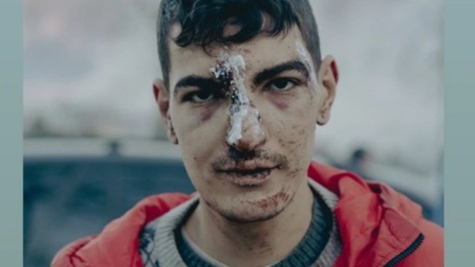 Yaralı insanlara hiç denk geldiniz mi?