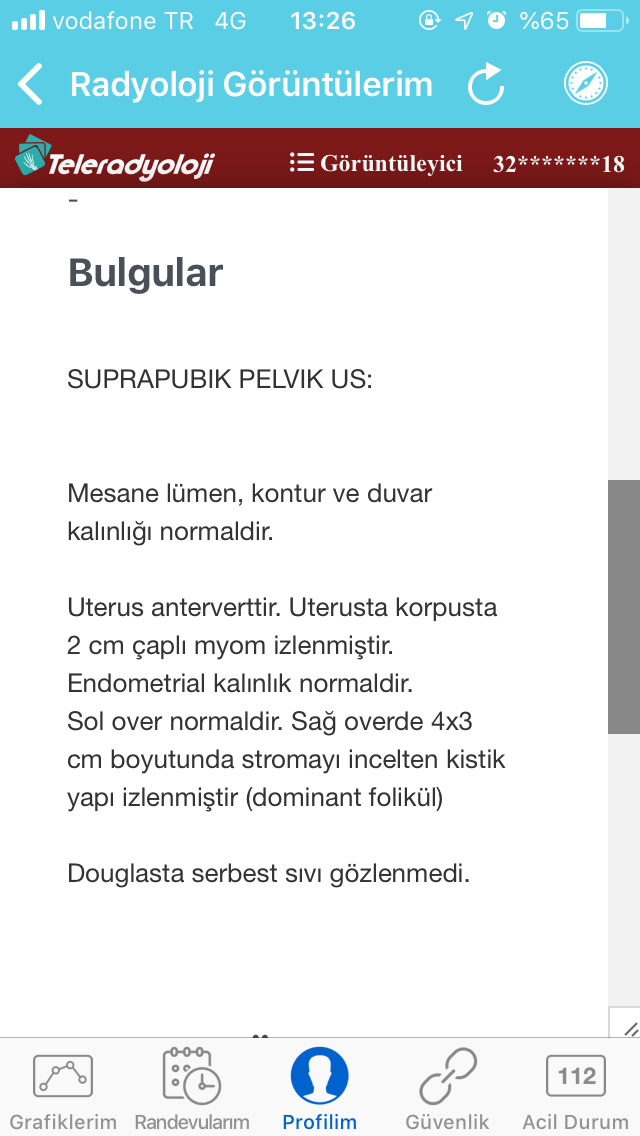 Jinekoloji muayenesinde ultrasona girdim. Sonuç bu çıktı. Ciddi midir?
