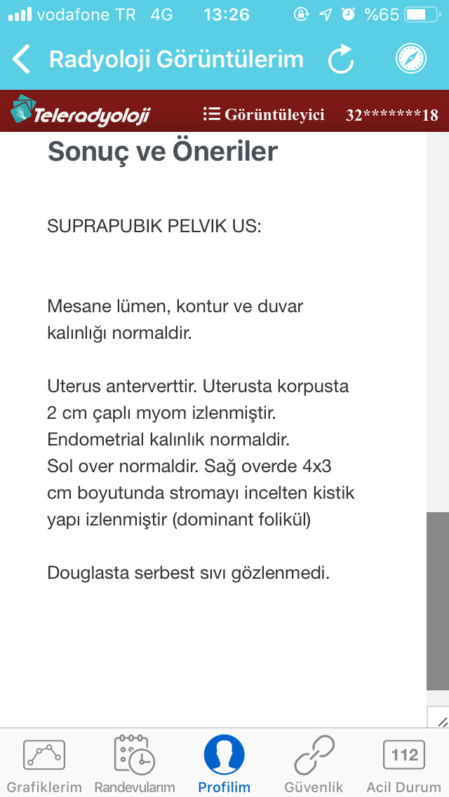 Jinekoloji muayenesinde ultrasona girdim. Sonuç bu çıktı. Ciddi midir?