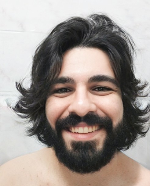 Yaş 27 göz altı ve ve yan bölgeler gülerken aşırı şekilde kırışıyor ne yapmalıyım?
