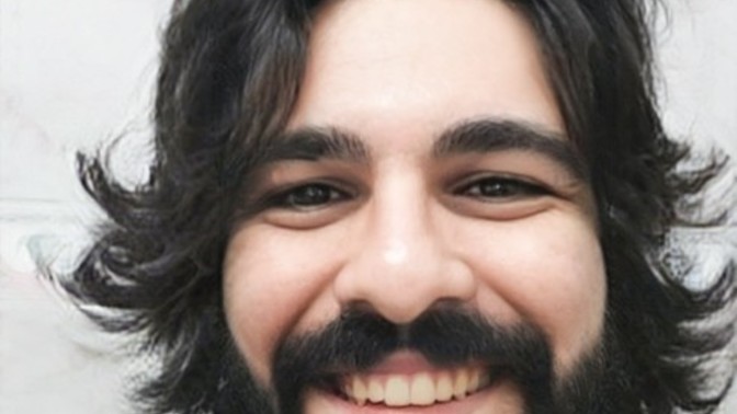 Yaş 27 göz altı ve ve yan bölgeler gülerken aşırı şekilde kırışıyor ne yapmalıyım?