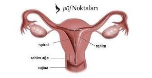 Spiral ücreti ne kadar?