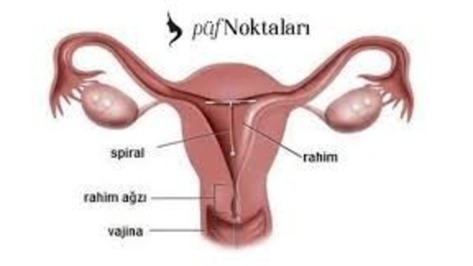 Spiral ücreti ne kadar?