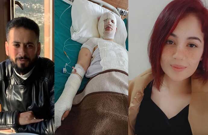 Deprem nedeniyle evine sığınan eski eşinin üstüne kaynar su döktü! bu konuda ne söylemek istersiniz?