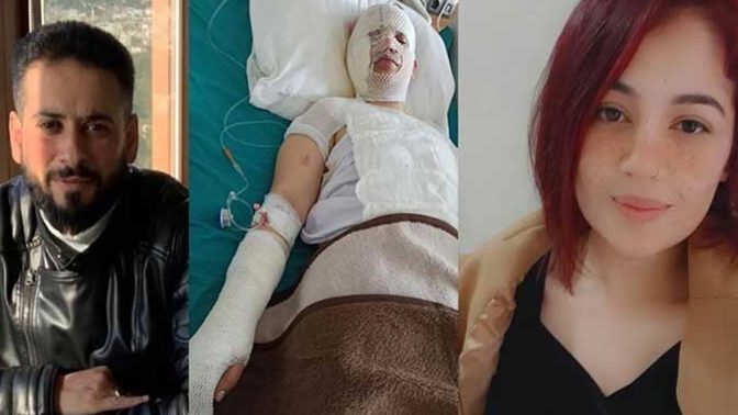 Deprem nedeniyle evine sığınan eski eşinin üstüne kaynar su döktü! bu konuda ne söylemek istersiniz?