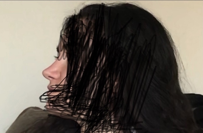Kızlar, Burnum estetikle ilk fotoğraftaki gibi olabilir mi?
