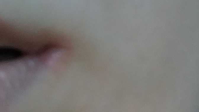 Dudağımda böyle bir şey çıktı. Yaşayan var mı?