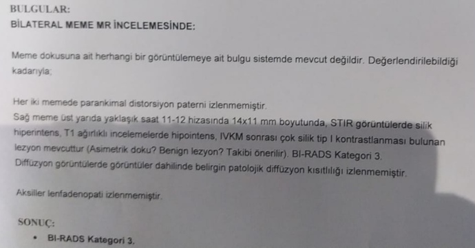 Kanser miyim, sonucuma bakar mısınız?