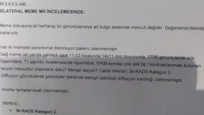 Kanser miyim, sonucuma bakar mısınız?