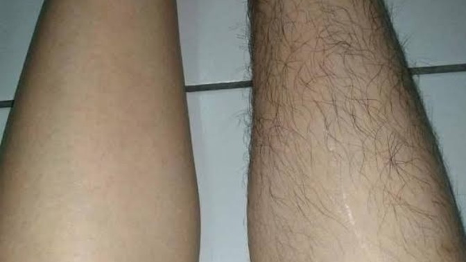 Sevgilimle her görüşmede bu işkenceyi yaşamak zorunda mıyım?