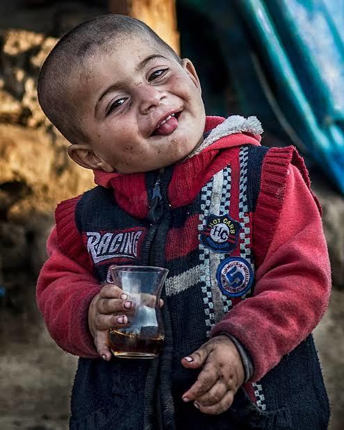 Aşırı çay, süt, ve sıvı tüketmek çocuklar için sağlıksız mı olur?