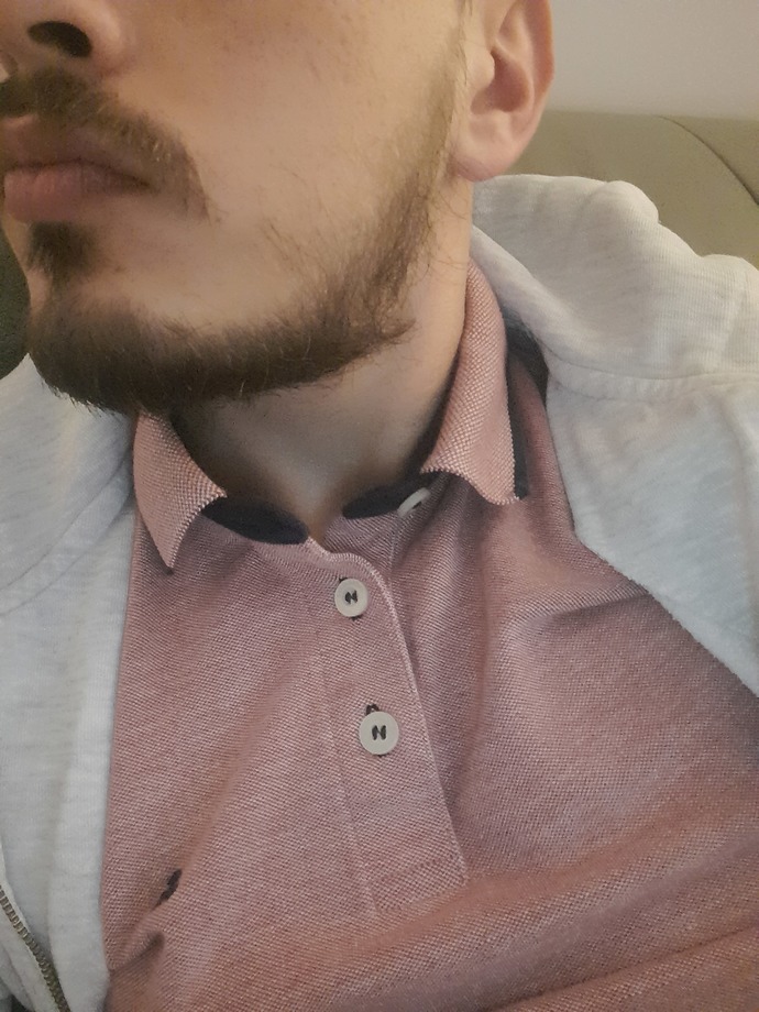Beyler sakalım belirli yerlerde çıkmıyor önerebileceğiniz birşeyler var mı?