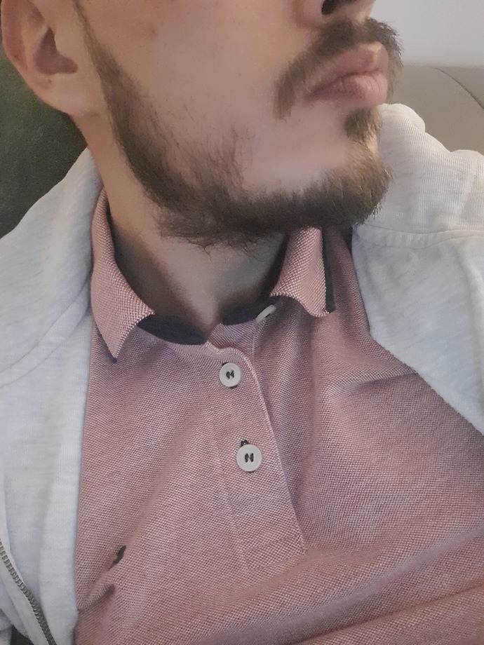 Beyler sakalım belirli yerlerde çıkmıyor önerebileceğiniz birşeyler var mı?