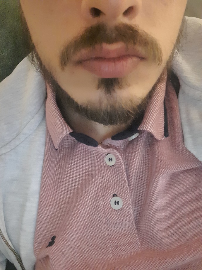 Beyler sakalım belirli yerlerde çıkmıyor önerebileceğiniz birşeyler var mı?