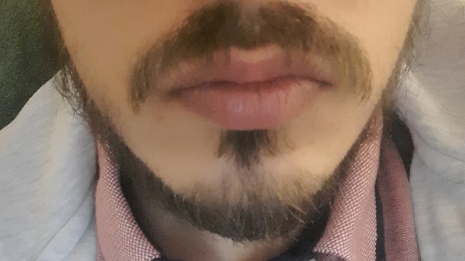 Beyler sakalım belirli yerlerde çıkmıyor önerebileceğiniz birşeyler var mı?