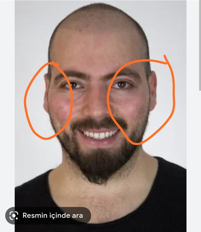 Yanaklarımda böyle kemik çıkıntısı var asla yakışıklı olamayacak mıyım?
