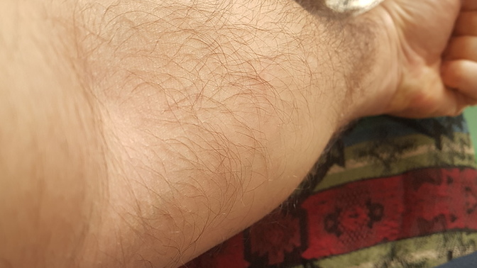Bileklerim kalın mı?