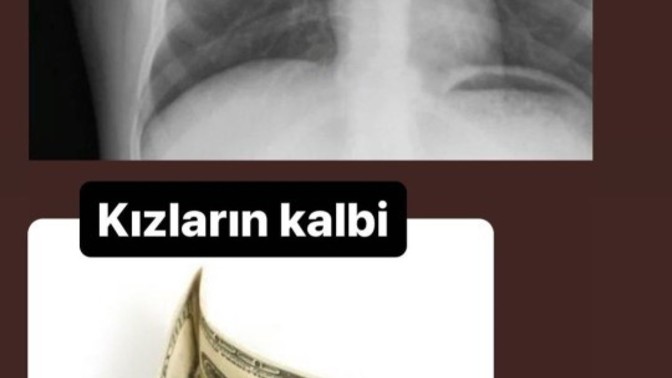 Gerçekten kadınlar erkeklerde, paraya mı bakıyorlar?