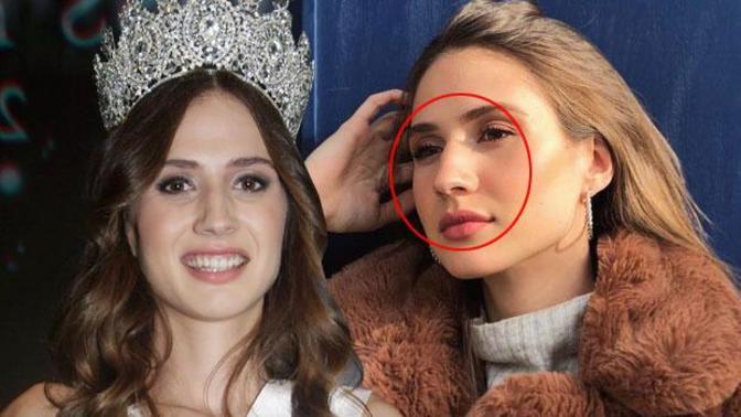 Kemerli buruna sahip olan herkes çirkin midir?