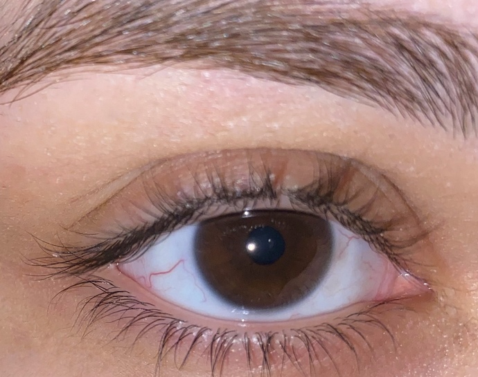 Göz bebeğimdeki renk açılması normal mi, renkli lens kullanımından kaynaklı olabilir?