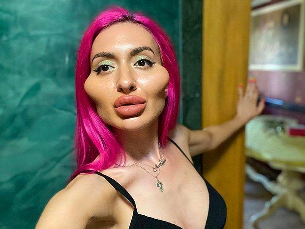 Her yeri estetik olan biriyle çıkar mıydın?