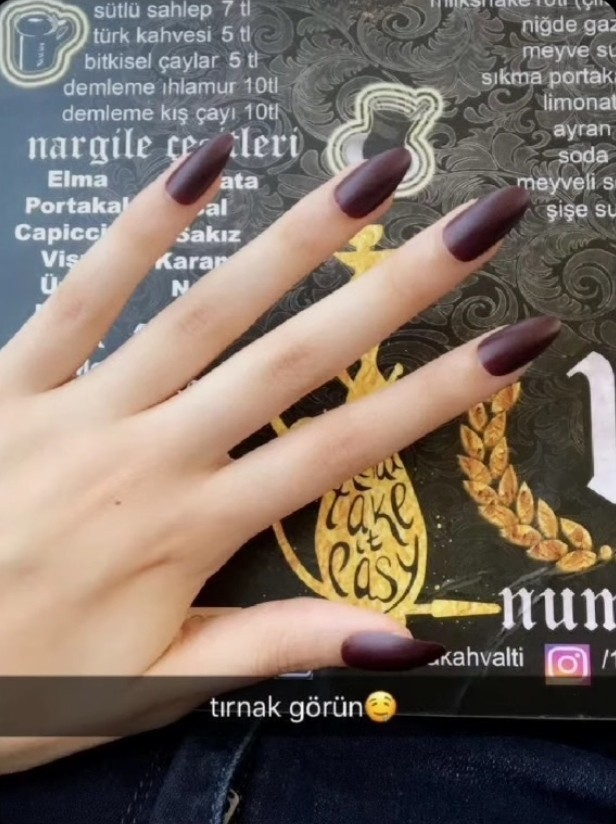 Elleri böyle olan kızların pilavı lapa yapmasında sorun var mı beyler?