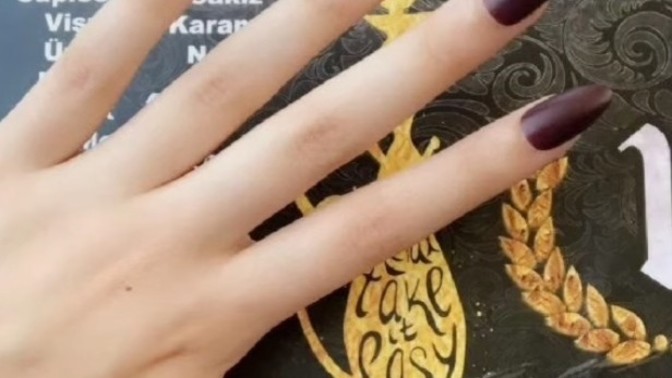 Elleri böyle olan kızların pilavı lapa yapmasında sorun var mı beyler?