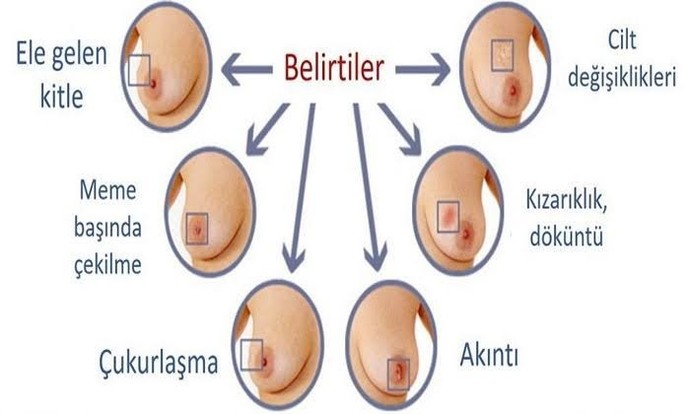 Bisey soracağım merhaba?