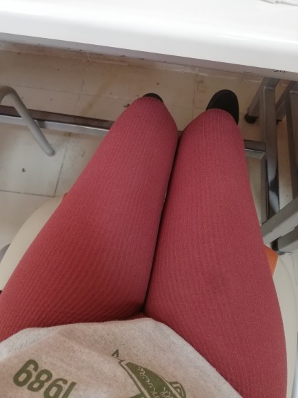 Bacaklarım şekilsiz mi?