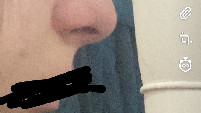 Sizce burnum kötü mü?