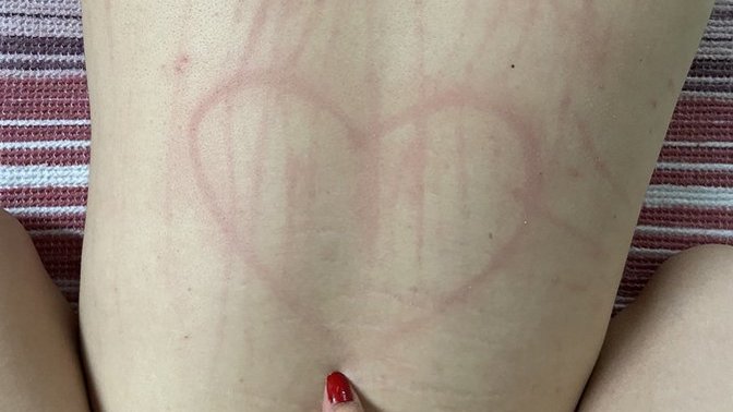 Her seksten sonra sırtım böyle oluyor, kızlar neden böyle yapıyorsunuz :) ?