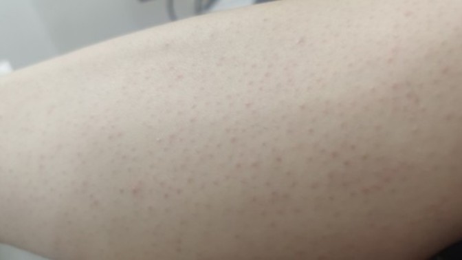 Kıllarımı alınca böyle oluyor. Pürüzsüz olmasını istiyorum, nasıl yapabilirim?