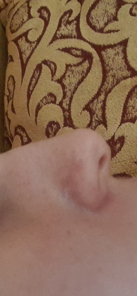 Burnun büyük olması çok kötü hissettiriyor. Bu psikolojiden nasıl kurtulurum?