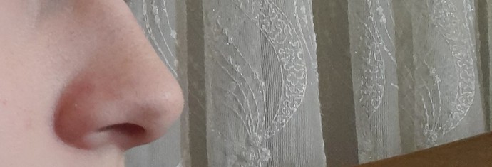 Burnun büyük olması çok kötü hissettiriyor. Bu psikolojiden nasıl kurtulurum?