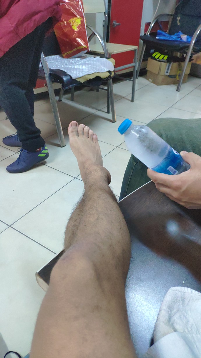Midesi hassas olan bakmasın, ayaktaki enfeksiyon kaç günde geçer?