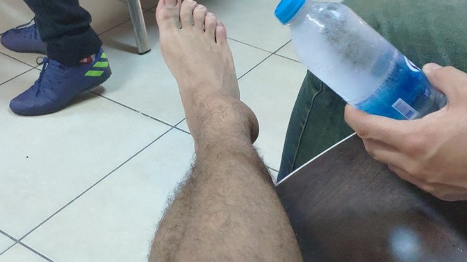 Midesi hassas olan bakmasın, ayaktaki enfeksiyon kaç günde geçer?