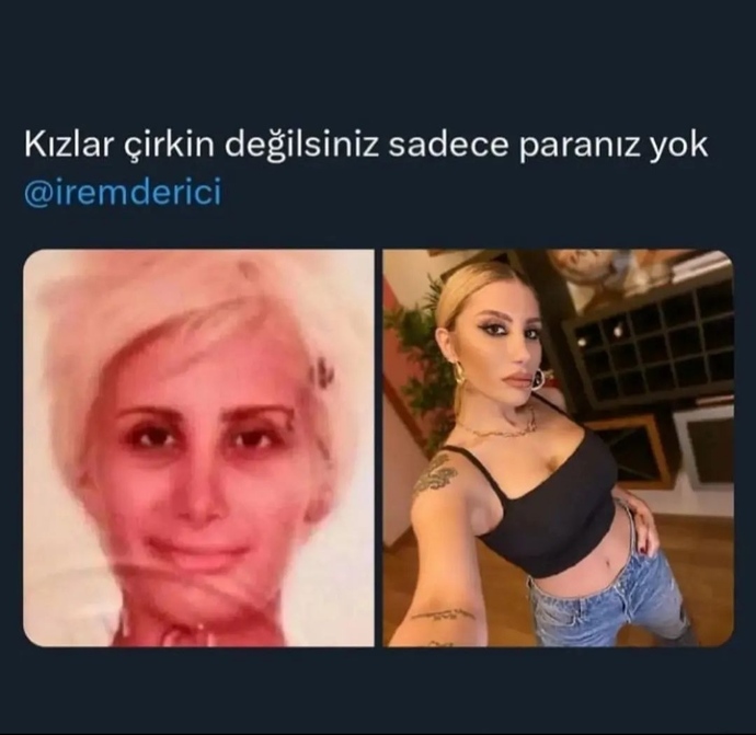 Parayla güzellik olur mu?😂