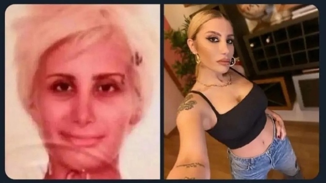 Parayla güzellik olur mu?😂