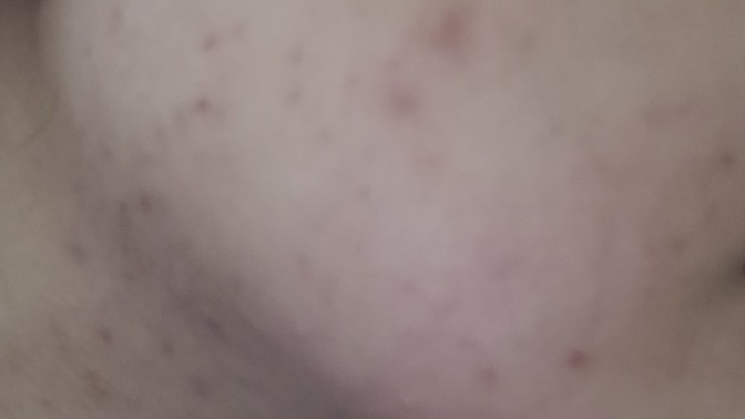 Yüzüm yıllardır böyle doktora da gittim, her türlü yolu denedim düzelmedi. Ne yapmalıyım?