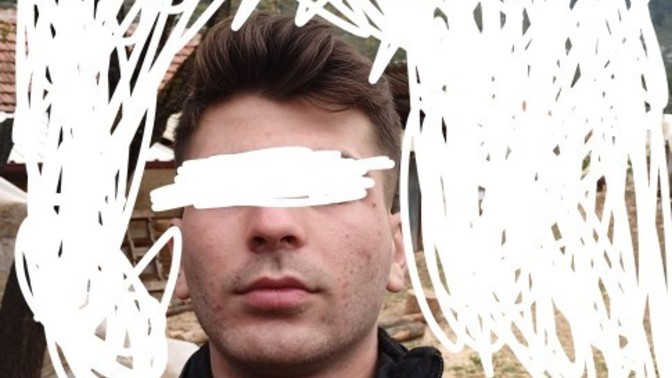 Bu sivilce izleri nasıl geçer?