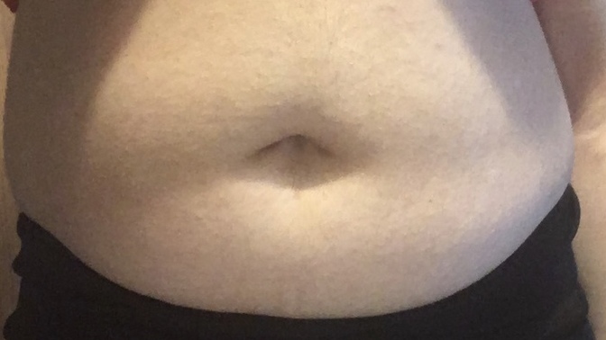 48 kiloyum 150 boyum var. Sadece göbeğimde yağlanma oluyo, kaç kilo olursam bu göbek tamamen gider sizce?