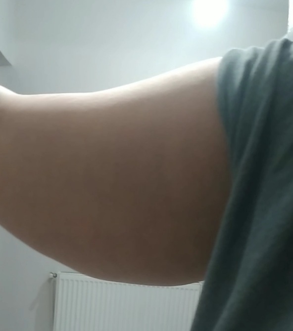 Düzenli spor ve diyetle bu kolda sarkma gerçekleşir mi?