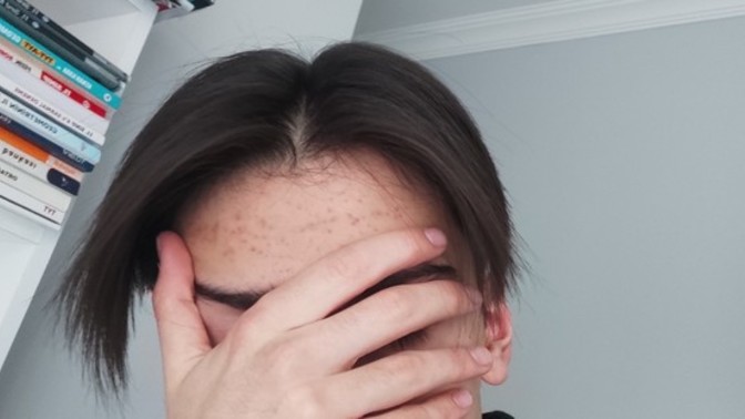 Keratin bakım sonrası saç?