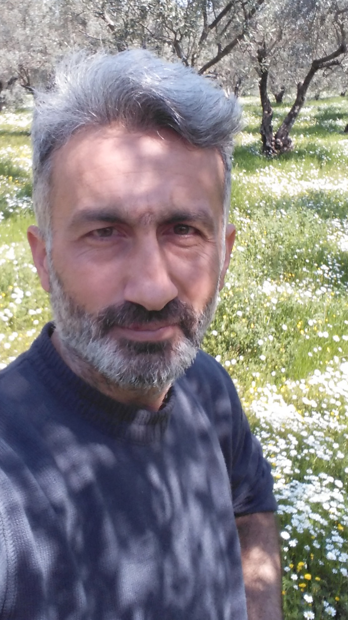 Sizce kaşımı mı yoksa burnumu mu aldırmalıyım?