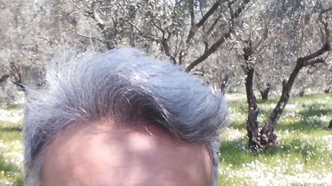 Sizce kaşımı mı yoksa burnumu mu aldırmalıyım?