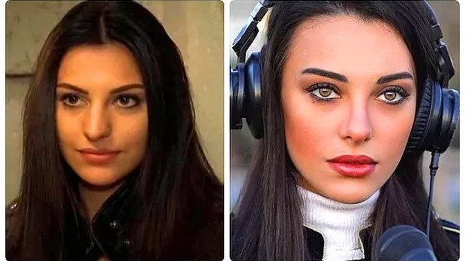 Kemerli burunlu bir kız güzel olamaz mı, bu burun şekli çok mu kötüdür?