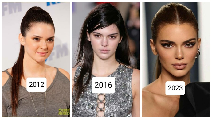 Kendall Jenner